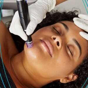 Hydra Facial