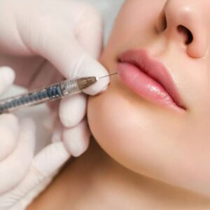 Lip Fillers